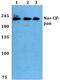 Sodium Voltage-Gated Channel Alpha Subunit 10 antibody, PA5-36074, Invitrogen Antibodies, Western Blot image 