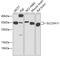 Solute Carrier Family 25 Member 11 antibody, 23-441, ProSci, Western Blot image 