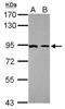 Nuclear Receptor Subfamily 3 Group C Member 1 antibody, NBP2-42221, Novus Biologicals, Western Blot image 