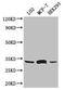 ADP/ATP translocase 3 antibody, CSB-PA021520LA01HU, Cusabio, Western Blot image 