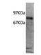 Interleukin 7 Receptor antibody, DDX0700P-100, Novus Biologicals, Immunoprecipitation image 
