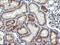 UDP-GlcNAc:BetaGal Beta-1,3-N-Acetylglucosaminyltransferase 2 antibody, M09524-1, Boster Biological Technology, Immunohistochemistry paraffin image 