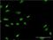 LIM/homeobox protein Lhx6 antibody, H00026468-M02, Novus Biologicals, Immunofluorescence image 