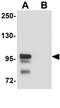 SCUBE2 antibody, GTX85173, GeneTex, Western Blot image 
