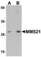 LRAT Domain Containing 2 antibody, NBP1-76263, Novus Biologicals, Western Blot image 