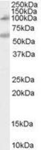 Nucleotide Binding Oligomerization Domain Containing 2 antibody, GTX89233, GeneTex, Western Blot image 