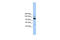 RNA Polymerase III Subunit B antibody, 30-455, ProSci, Western Blot image 