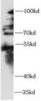 Zinc Finger Protein 746 antibody, FNab10734, FineTest, Western Blot image 
