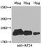 Osmotin antibody, A64274-100, Epigentek, Western Blot image 