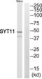 Synaptotagmin 11 antibody, abx014931, Abbexa, Western Blot image 