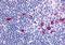 Cannabinoid Receptor 2 antibody, orb85655, Biorbyt, Immunohistochemistry paraffin image 