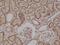 B-Raf Proto-Oncogene, Serine/Threonine Kinase antibody, NBP2-61499, Novus Biologicals, Immunohistochemistry paraffin image 