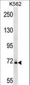 SAM And HD Domain Containing Deoxynucleoside Triphosphate Triphosphohydrolase 1 antibody, LS-C158915, Lifespan Biosciences, Western Blot image 