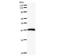 CCCTC-Binding Factor antibody, LS-C342619, Lifespan Biosciences, Western Blot image 