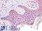 CD63 Molecule antibody, LS-A11974, Lifespan Biosciences, Immunohistochemistry paraffin image 