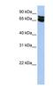 GM2/GD2 synthase antibody, NBP1-62535, Novus Biologicals, Western Blot image 