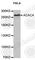 Acetyl-CoA Carboxylase Alpha antibody, A0110, ABclonal Technology, Western Blot image 