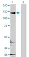 Cytoplasmic FMR1 Interacting Protein 2 antibody, H00026999-M01, Novus Biologicals, Western Blot image 