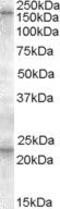 ATP Binding Cassette Subfamily C Member 8 antibody, PA5-18974, Invitrogen Antibodies, Western Blot image 