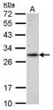 Ring Finger Protein 212 antibody, GTX118251, GeneTex, Western Blot image 