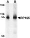 CD180 Molecule antibody, orb74729, Biorbyt, Western Blot image 