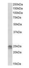 Fibroblast Growth Factor 8 antibody, orb146461, Biorbyt, Western Blot image 