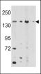 5-Oxoprolinase, ATP-Hydrolysing antibody, LS-C100684, Lifespan Biosciences, Western Blot image 