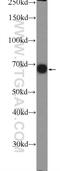 Glyceronephosphate O-Acyltransferase antibody, 14931-1-AP, Proteintech Group, Western Blot image 