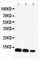 C-X-C Motif Chemokine Ligand 16 antibody, PA1460, Boster Biological Technology, Western Blot image 