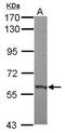 Zinc Finger Protein 417 antibody, GTX121370, GeneTex, Western Blot image 
