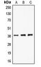 Chloride Nucleotide-Sensitive Channel 1A antibody, orb213752, Biorbyt, Western Blot image 