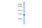 Survival Motor Neuron Domain Containing 1 antibody, 25-633, ProSci, Western Blot image 