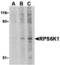 Ribosomal Protein S6 Kinase A1 antibody, MBS150766, MyBioSource, Western Blot image 