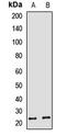 Heparin Binding EGF Like Growth Factor antibody, LS-C667834, Lifespan Biosciences, Western Blot image 