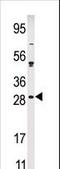 Calcium And Integrin Binding Family Member 2 antibody, LS-C100926, Lifespan Biosciences, Western Blot image 