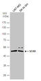 SRY-Box 8 antibody, GTX129949, GeneTex, Western Blot image 