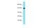 Diacylglycerol Kinase Delta antibody, PA5-70714, Invitrogen Antibodies, Western Blot image 