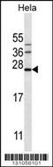 Serglycin antibody, 56-327, ProSci, Western Blot image 