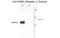 Gamma-Aminobutyric Acid Type A Receptor Beta3 Subunit antibody, GTX82681, GeneTex, Western Blot image 