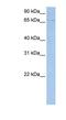 ATP Binding Cassette Subfamily F Member 3 antibody, NBP1-59381, Novus Biologicals, Western Blot image 