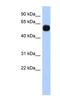 Membrane Palmitoylated Protein 7 antibody, NBP1-53081, Novus Biologicals, Western Blot image 