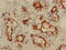 Nucleolar Protein 3 antibody, LS-C370045, Lifespan Biosciences, Immunohistochemistry paraffin image 