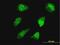 Homeobox D11 antibody, H00003237-M03, Novus Biologicals, Immunofluorescence image 