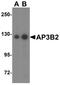 Adaptor Related Protein Complex 3 Subunit Beta 2 antibody, A09539, Boster Biological Technology, Western Blot image 