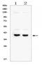 Doublesex And Mab-3 Related Transcription Factor 1 antibody, RP1083, Boster Biological Technology, Western Blot image 