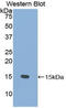 Prostate Stem Cell Antigen antibody, LS-C302055, Lifespan Biosciences, Western Blot image 