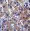 MLX Interacting Protein Like antibody, LS-C164225, Lifespan Biosciences, Immunohistochemistry frozen image 