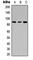 Leucine Rich Repeat Containing G Protein-Coupled Receptor 6 antibody, abx121910, Abbexa, Western Blot image 