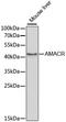 Alpha-Methylacyl-CoA Racemase antibody, A1130, ABclonal Technology, Western Blot image 