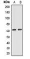 Chromatin Assembly Factor 1 Subunit B antibody, orb412440, Biorbyt, Western Blot image 